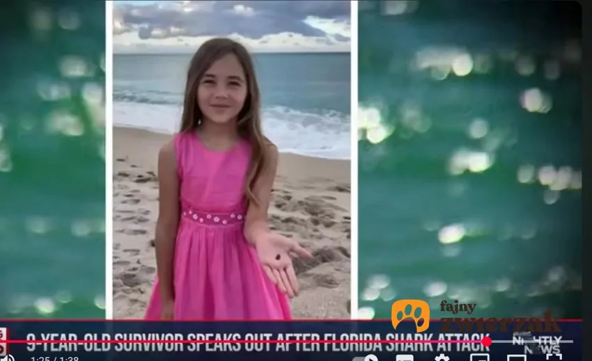Leah została ugryziona przez rekina, fot. YouTube NBCNews Dziewczynka w różowej sukience
